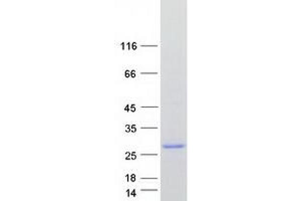 RAP1A Protein (Transcript Variant 2) (Myc-DYKDDDDK Tag)