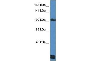 Western Blot showing DSG3 antibody used at a concentration of 1 ug/ml against HepG2 Cell Lysate (Desmoglein 3 anticorps  (C-Term))