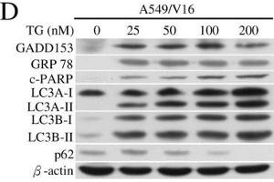 Western Blotting (WB) image for anti-Sequestosome 1 (SQSTM1) antibody (ABIN2854836)