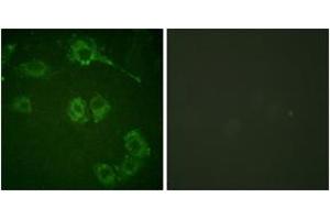 Immunofluorescence analysis of HuvEc cells, using COT (Ab-290) Antibody. (CROT anticorps  (AA 256-305))