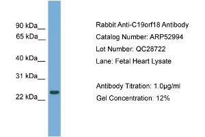WB Suggested Anti-C19orf18  Antibody Titration: 0. (C19orf18 anticorps  (N-Term))