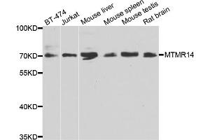 Western blot analysis of extracts of various cell lines, using MTMR14 antibody. (MTMR14 anticorps)