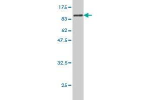 Western Blot detection against Immunogen (89. (CDKN2AIP anticorps  (AA 1-579))