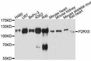Western blot analysis of extracts of various cell lines, using P2RX5 antibody (ABIN5998432) at 1:3000 dilution. (P2RX5 anticorps)
