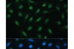 Immunofluorescence analysis of U-2 OS cells using ATF3 Polyclonal Antibody at dilution of 1:100. (ATF3 anticorps)