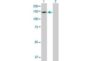 Western Blot analysis of DNMT3A expression in transfected 293T cell line by DNMT3A MaxPab polyclonal antibody. (DNMT3A anticorps  (AA 1-912))
