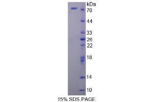 Image no. 1 for FK506 Binding Protein 4, 59kDa (FKBP4) (AA 2-459) protein (His tag,GST tag) (ABIN6237360) (FKBP4 Protein (AA 2-459) (His tag,GST tag))