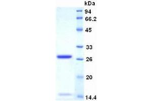 SDS-PAGE analysis of Human Ki-67 Protein. (Ki-67 Protéine)