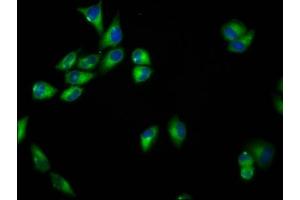 Immunofluorescence staining of Hela cells with ABIN7168823 at 1:33, counter-stained with DAPI. (SEMA6B anticorps  (AA 756-888))