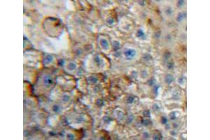 Used in DAB staining on fromalin fixed paraffin-embedded liver tissue (CD101 anticorps  (AA 566-784))
