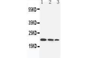 Anti-IL-10 antibody, Western blotting Lane 1: Recombinant Human IL-10 Protein 10ng Lane 2: Recombinant Human IL-10 Protein 5ng Lane 3: Recombinant Human IL-10 Protein 2. (IL-10 anticorps  (N-Term))