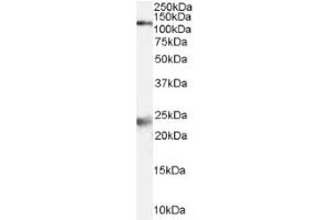 Image no. 1 for anti-NMDA Receptor 1 (NMDA R1) (Internal Region) antibody (ABIN374717) (NMDA 1 Receptor anticorps  (Internal Region))