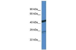 Western Blot showing Dgat2 antibody used at a concentration of 1. (DGAT2 anticorps  (C-Term))