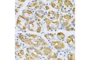 Immunohistochemistry of paraffin-embedded human stomach using SDC4 Antibody (ABIN1874710) at dilution of 1:100 (40x lens). (SDC4 anticorps)