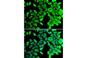 Immunofluorescence analysis of A549 cell using THADA antibody. (THADA anticorps)