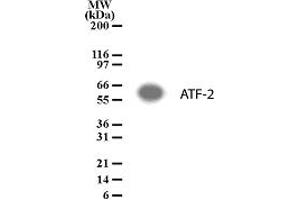 Western Blotting (WB) image for anti-Activating Transcription Factor 2 (ATF2) (AA 13-27) antibody (ABIN208330) (ATF2 anticorps  (AA 13-27))