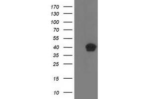 HEK293T cells were transfected with the pCMV6-ENTRY control (Left lane) or pCMV6-ENTRY RLBP1 (Right lane) cDNA for 48 hrs and lysed. (RLBP1 anticorps)