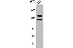 Western Blot analysis of 293 cells using Phospho-Flg (Y154) Polyclonal Antibody (FGFR1 anticorps  (pTyr154))