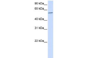 WB Suggested Anti-PPP3CA Antibody Titration:  0. (PPP3CA anticorps  (N-Term))