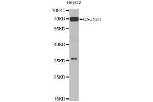 Western blot analysis of extracts of HepG2 cells, using CACNB1 Antibody. (CACNB1 anticorps  (AA 429-598))