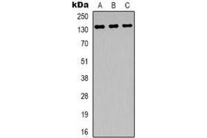 Western blot analysis of ABL1 expression in Hela (A), SHSY5Y (B), NIH3T3 (C) whole cell lysates. (ABL1 anticorps)