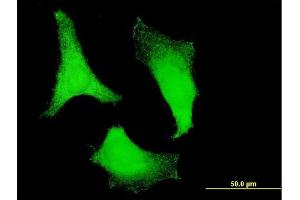 Immunofluorescence (IF) image for anti-Ribosomal Protein S2 (RPS2) (AA 198-293) antibody (ABIN562714)