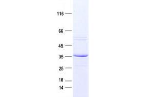 Validation with Western Blot (Ret Proto-Oncogene Protein (RET) (DYKDDDDK Tag))