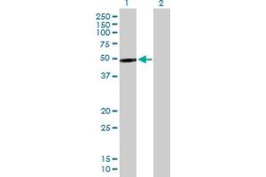 Western Blot analysis of PIP4K2B expression in transfected 293T cell line by PIP4K2B MaxPab polyclonal antibody. (PIP4K2B anticorps  (AA 1-416))