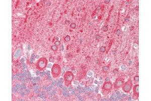 Mouse Brain, Cerebellum: Formalin-Fixed, Paraffin-Embedded (FFPE) (TRAF6 anticorps  (AA 1-305))