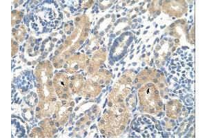 KHK antibody was used for immunohistochemistry at a concentration of 4-8 ug/ml. (Ketohexokinase anticorps)