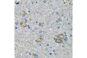 Immunohistochemistry of paraffin-embedded mouse spinal cord using SSBP1 antibody (ABIN5974202) at dilution of 1/100 (40x lens). (SSBP1 anticorps)