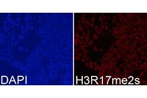 Immunofluorescence analysis of 293T cells using Symmetric DiMethyl-Histone H3-R17 antibody (ABIN3017470, ABIN3017471, ABIN3017472 and ABIN6220102). (Histone 3 anticorps  (H3R17me2))