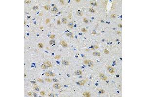 Immunohistochemistry of paraffin-embedded rat brain using TXNDC5 Antibody. (TXNDC5 anticorps  (AA 1-324))