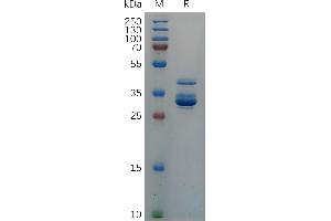 Cynomolgus C Protein, hFc Tag on SDS-PAGE under reducing condition. (CXCL10 Protein (AA 22-98) (Fc Tag))