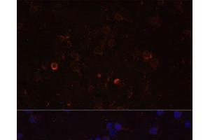 Immunofluorescence analysis of THP-1 cells using TLR4 Polyclonal Antibody at dilution of 1:100 (40x lens). (TLR4 anticorps)