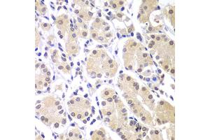 Immunohistochemistry of paraffin-embedded human gastric using CHEK1 antibody (ABIN5975848) at dilution of 1/100 (40x lens). (CHEK1 anticorps)