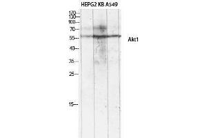 Western Blotting (WB) image for anti-V-Akt Murine Thymoma Viral Oncogene Homolog 1 (AKT1) (Ser134) antibody (ABIN3173743) (AKT1 anticorps  (Ser134))