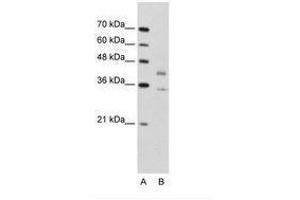 Image no. 1 for anti-DNA Fragmentation Factor, 45kDa, alpha Polypeptide (DFFA) (N-Term) antibody (ABIN203383) (DFFA anticorps  (N-Term))