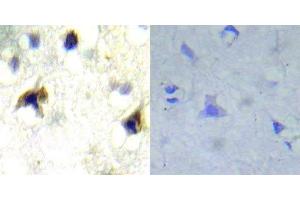 Immunohistochemical analysis of paraffin- embedded human brain carcinoma tissue using PDGFR beta (Ab-751) antibody (E022033). (PDGFRB anticorps)