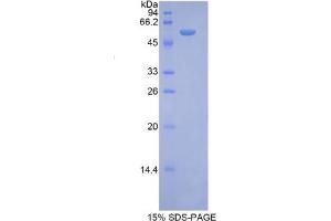 SDS-PAGE analysis of Mouse Ribophorin I Protein. (RPN1 Protéine)