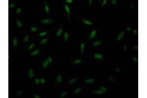 Immunofluorescence staining of Hela Cells with ABIN7127663 at 1:50, counter-stained with DAPI. (Recombinant PAK1 anticorps)