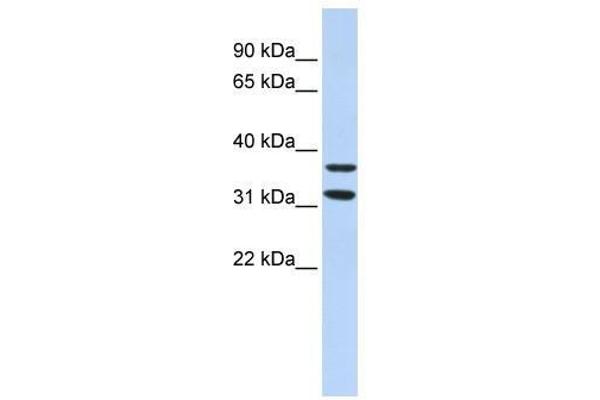 ZNF254 anticorps  (Middle Region)