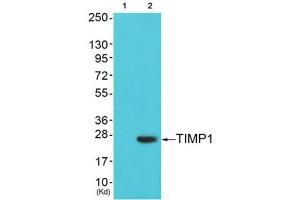 Western Blotting (WB) image for anti-TIMP Metallopeptidase Inhibitor 1 (TIMP1) (Internal Region) antibody (ABIN1848806) (TIMP1 anticorps  (Internal Region))