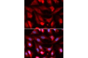 Immunofluorescence analysis of U2OS cells using SMAD4 antibody (ABIN5973302). (SMAD4 anticorps)