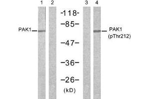 Western blot analysis of extracts from 293 cells, untreated or treated with forskolin (40µM, 30min), using PAK1 (Ab-212) antibody (E021160, Lane 1 and 2) and PAK1 (phospho-Thr212) antibody (E011154, Lane 3 and 4). (PAK1 anticorps)