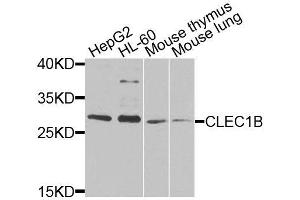 Western blot analysis of extracts of various cell lines, using CLEC1B antibody (ABIN6003679) at 1/1000 dilution. (C-Type Lectin Domain Family 1, Member B (CLEC1B) anticorps)
