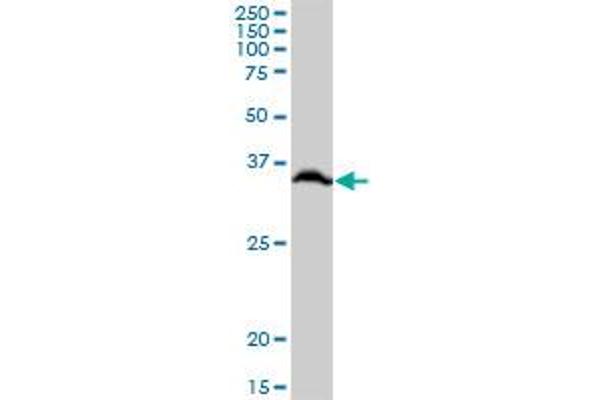 RPLP0 anticorps  (AA 1-317)