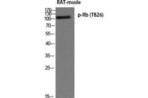 Western Blot (WB) analysis of Rat Muscle using p-Rb (T826) antibody. (Retinoblastoma 1 anticorps  (pThr826))