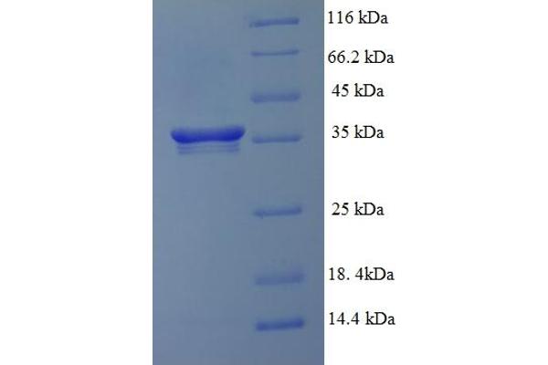 GC-Rich Promoter Binding Protein 1 (GPBP1) (AA 293-473), (partial) protein (His-SUMO Tag)