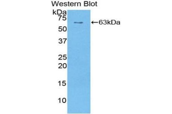 SULF1 anticorps  (AA 609-871)